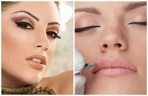 волендам и эдам