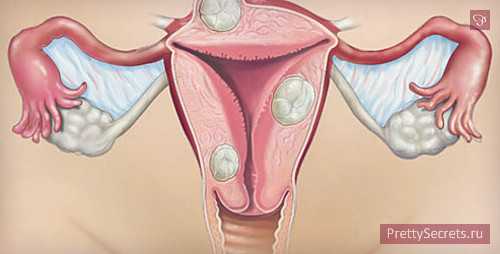 как бороться с вредными привычками