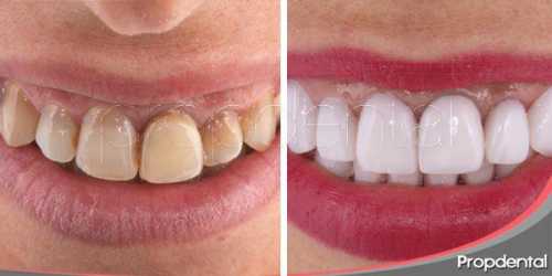 катя лель пожаловалась на кражу зубов инопланетянами